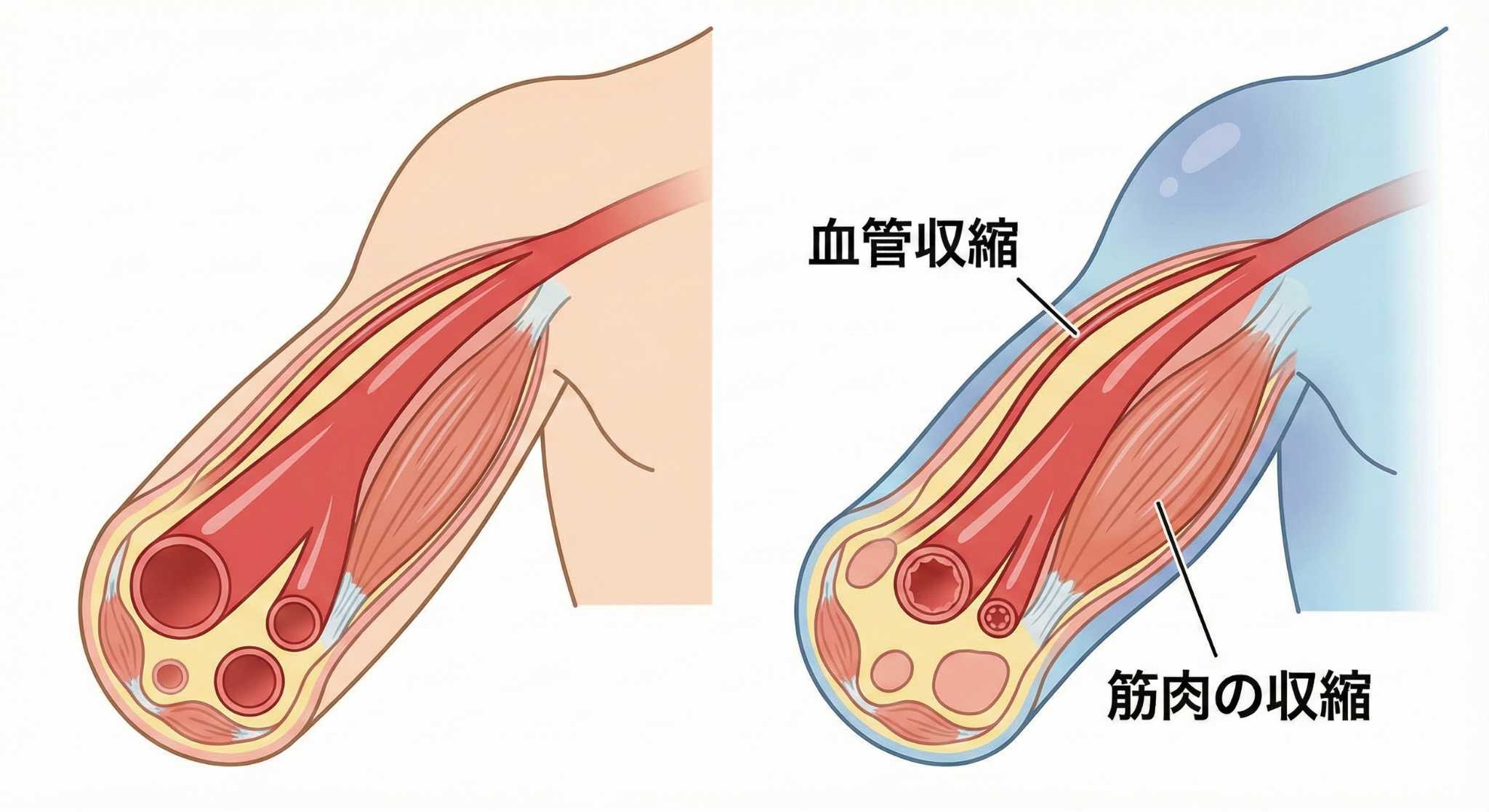 寒さで身体が縮こまるイメージ