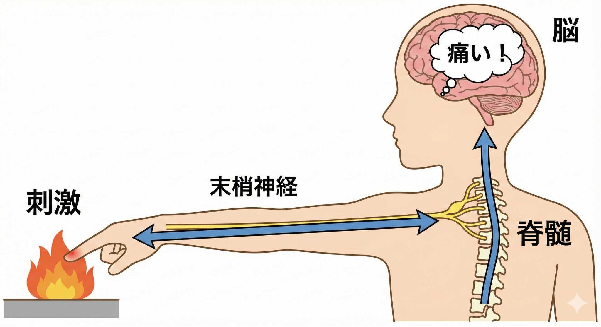 痛みが脳に伝わる仕組みの図解