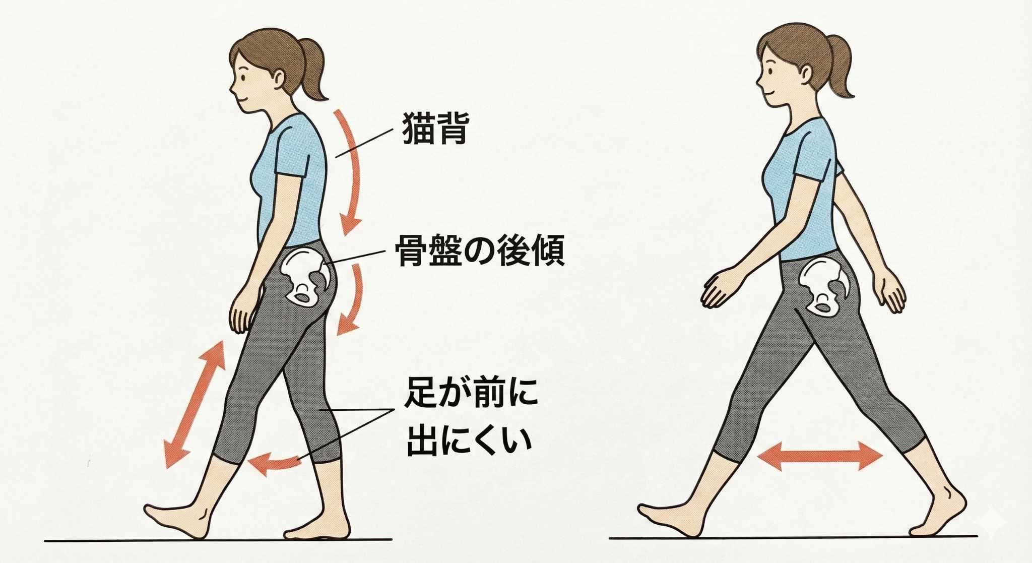 猫背だと足が出にくい図解